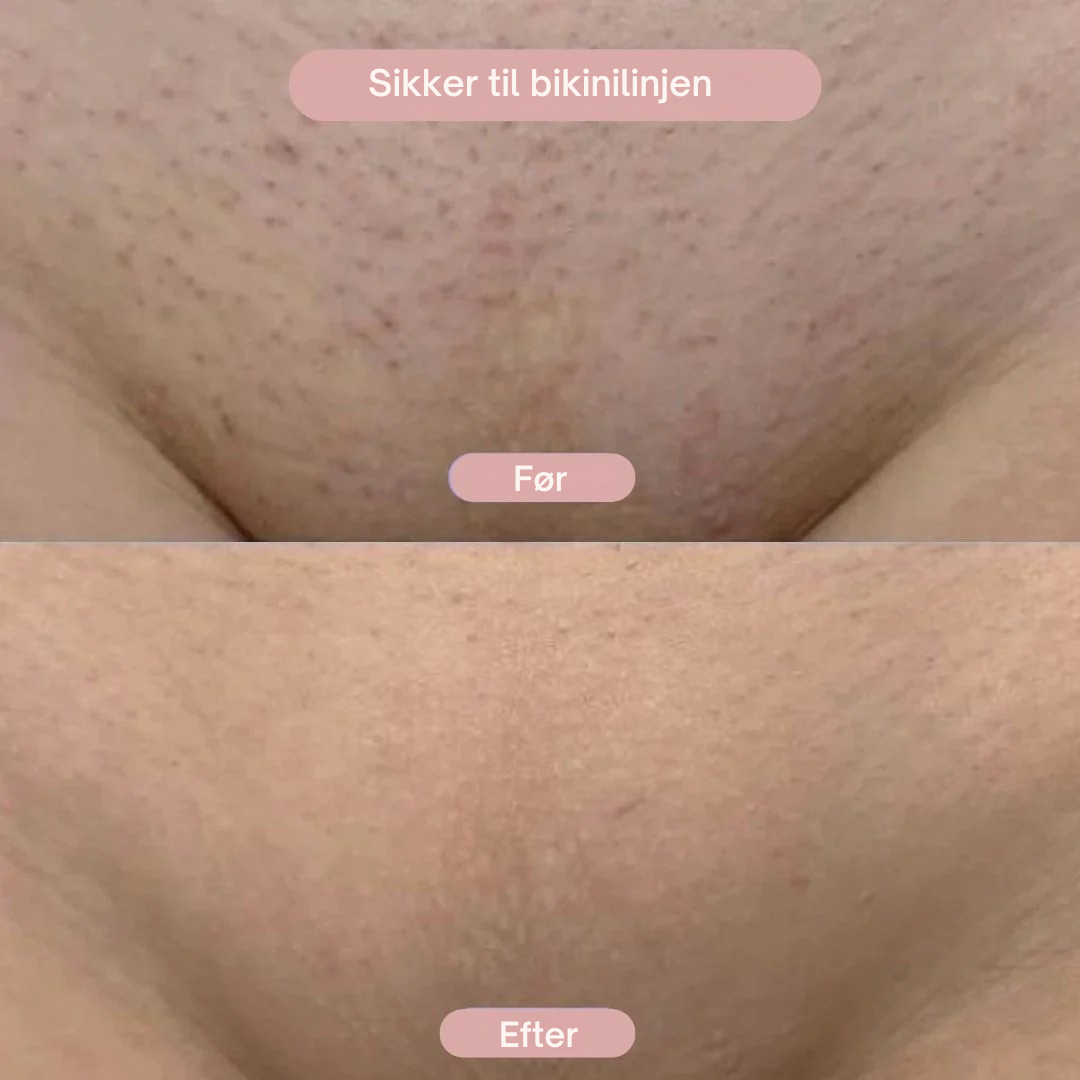 SilkPro™ - 2-i-1 Barbermaskine til Kvinder